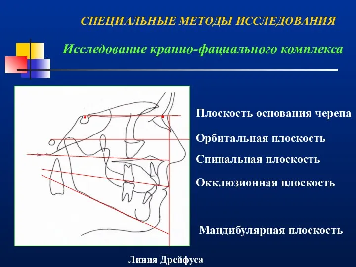 Исследование кранио-фациального комплекса . . Плоскость основания черепа Орбитальная плоскость Спинальная