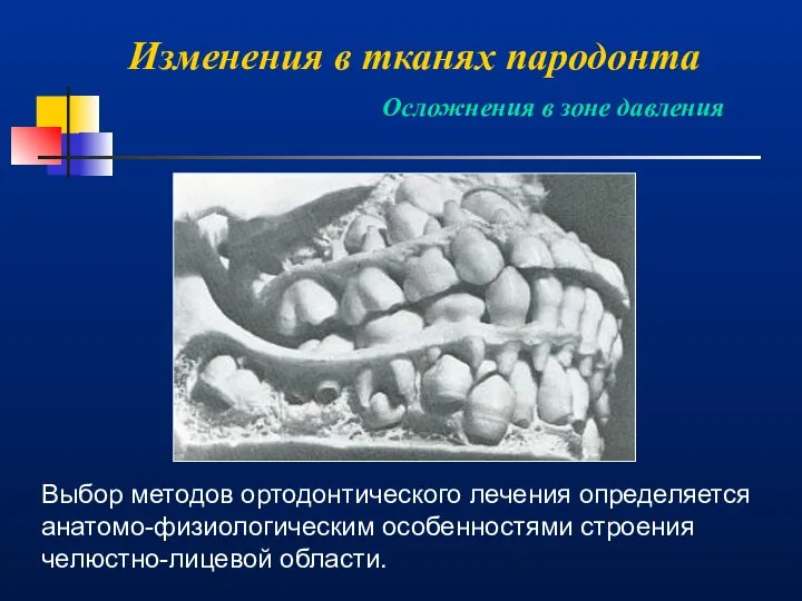 Изменения в тканях пародонта Осложнения в зоне давления Выбор методов ортодонтического