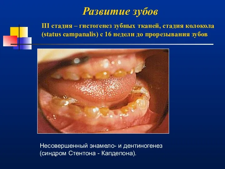 Развитие зубов III стадия – гистогенез зубных тканей, стадия колокола (status