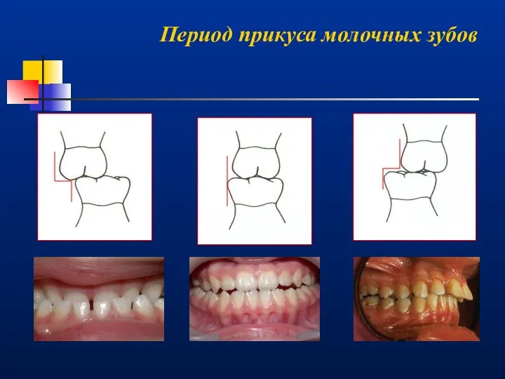 Период прикуса молочных зубов