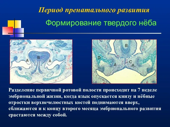 Период пренатального развития Разделение первичной ротовой полости происходит на 7 неделе