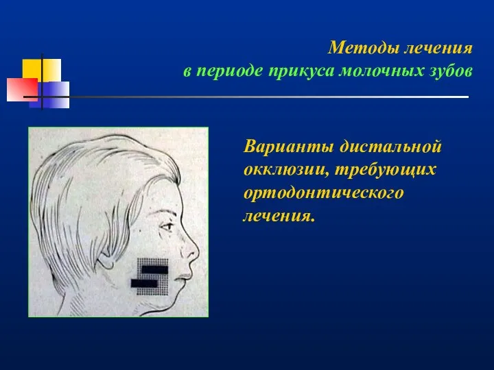 Методы лечения в периоде прикуса молочных зубов Варианты дистальной окклюзии, требующих ортодонтического лечения.