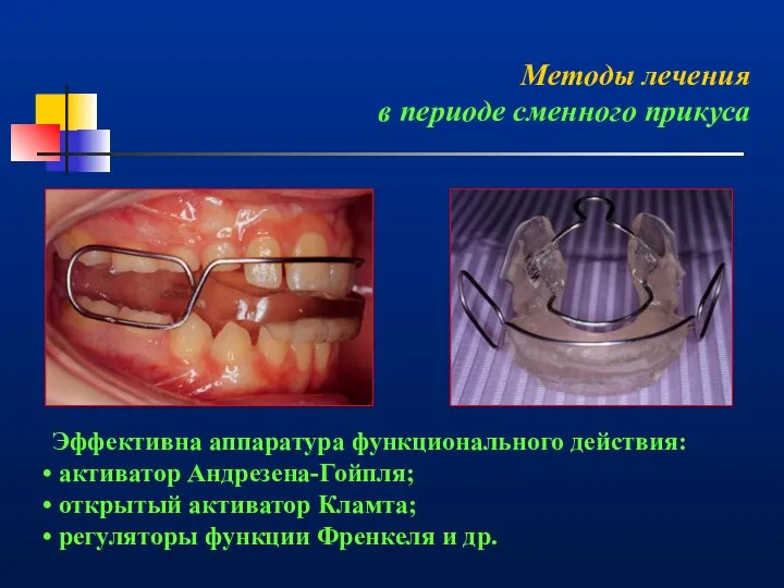 Методы лечения в периоде сменного прикуса Эффективна аппаратура функционального действия: активатор