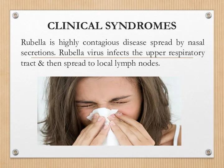 CLINICAL SYNDROMES Rubella is highly contagious disease spread by nasal secretions.