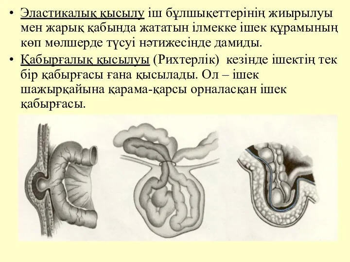 Эластикалық қысылу iш бұлшықеттерiнiң жиырылуы мен жарық қабында жататын iлмекке iшек