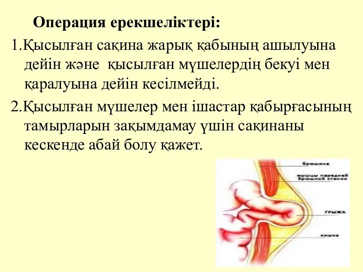 Операция ерекшелiктерi: 1.Қысылған сақина жарық қабының ашылуына дейiн және қысылған мүшелердiң