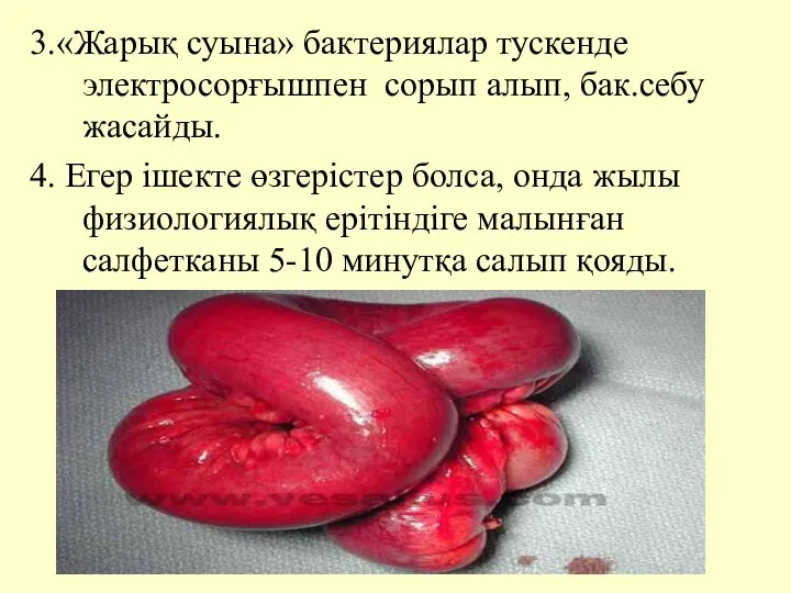 3.«Жарық суына» бактериялар тускенде электросорғышпен сорып алып, бак.себу жасайды. 4. Егер