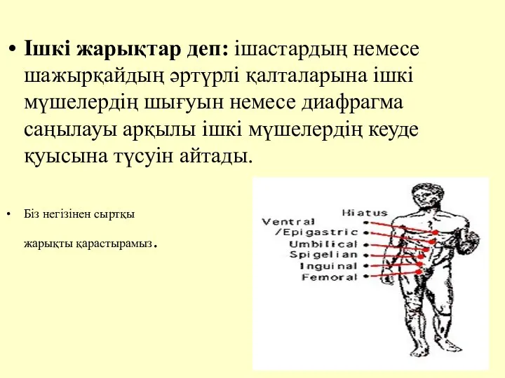 Iшкi жарықтар деп: iшастардың немесе шажырқайдың әртүрлi қалталарына iшкi мүшелердiң шығуын