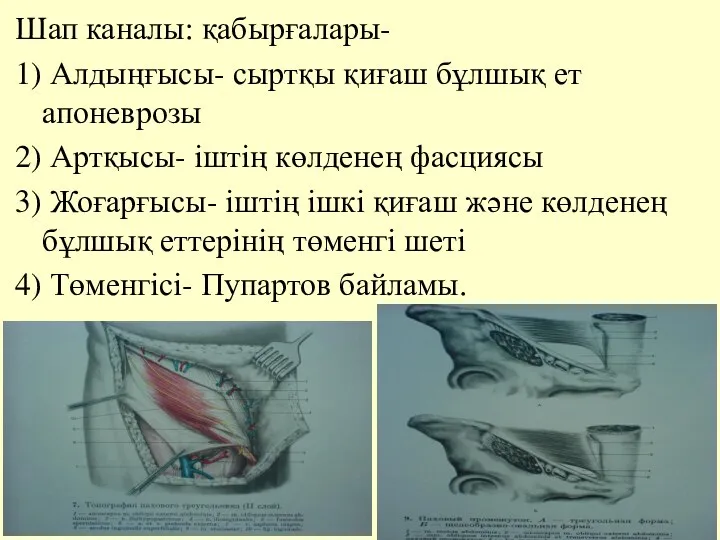 Шап каналы: қабырғалары- 1) Алдыңғысы- сыртқы қиғаш бұлшық ет апоневрозы 2)