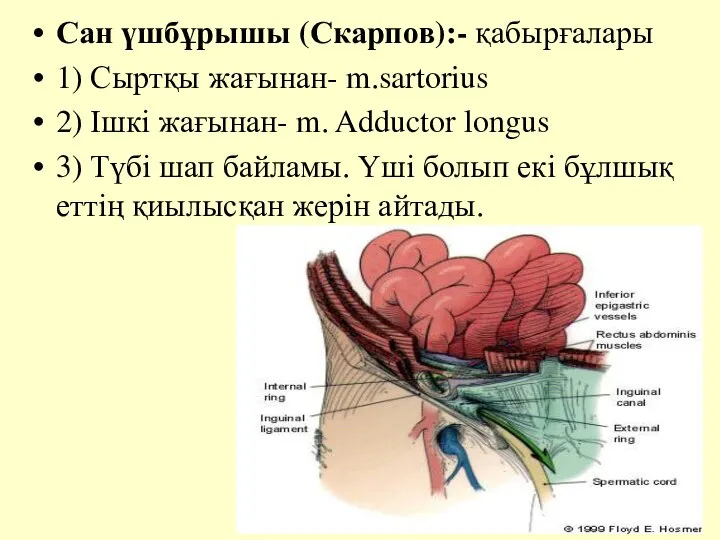 Сан үшбұрышы (Скарпов):- қабырғалары 1) Сыртқы жағынан- m.sartorius 2) Ішкі жағынан-