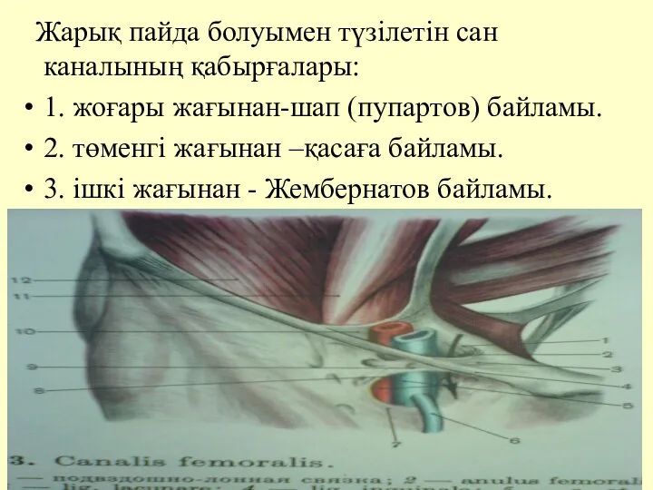 Жарық пайда болуымен түзiлетiн сан каналының қабырғалары: 1. жоғары жағынан-шап (пупартов)