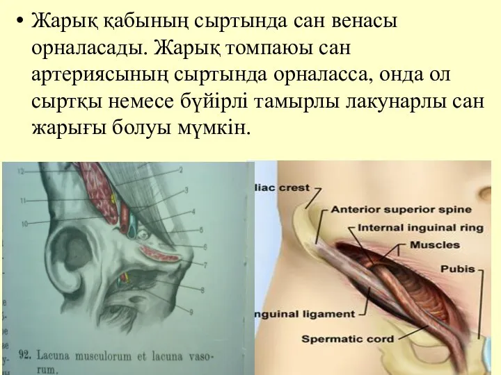 Жарық қабының сыртында сан венасы орналасады. Жарық томпаюы сан артериясының сыртында