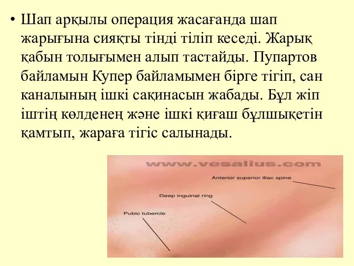 Шап арқылы операция жасағанда шап жарығына сияқты тiндi тiлiп кеседi. Жарық