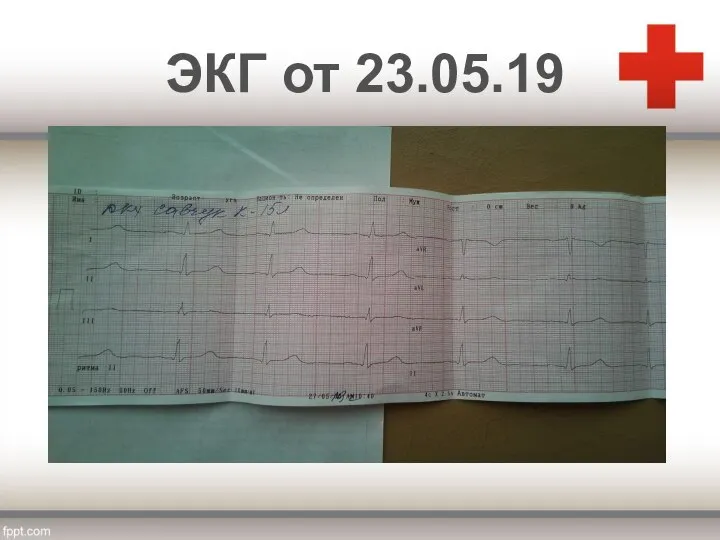 ЭКГ от 23.05.19