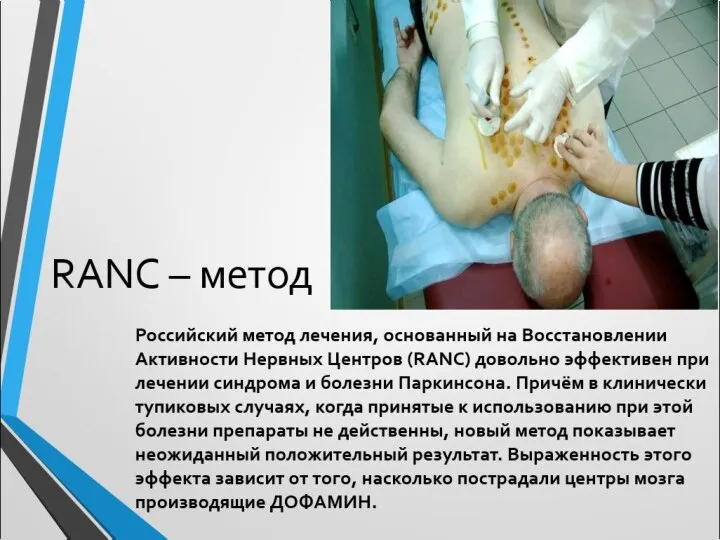RANC – метод Российский метод лечения, основанный на Восстановлении Активности Нервных
