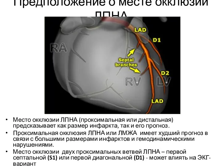 Предположение о месте окклюзии ЛПНА Место окклюзии ЛПНА (проксимальная или дистальная)