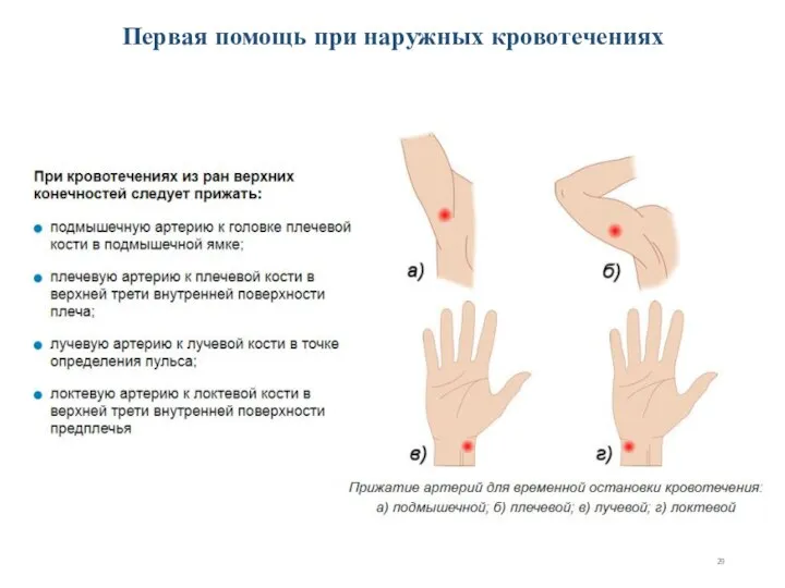 Первая помощь при наружных кровотечениях