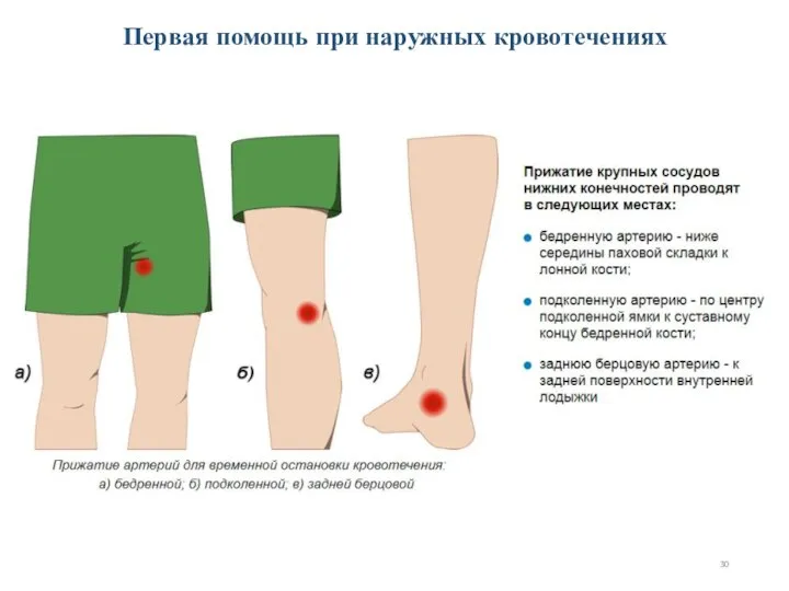 Первая помощь при наружных кровотечениях