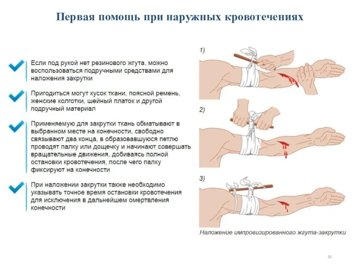 Первая помощь при наружных кровотечениях