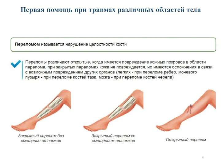 Первая помощь при травмах различных областей тела