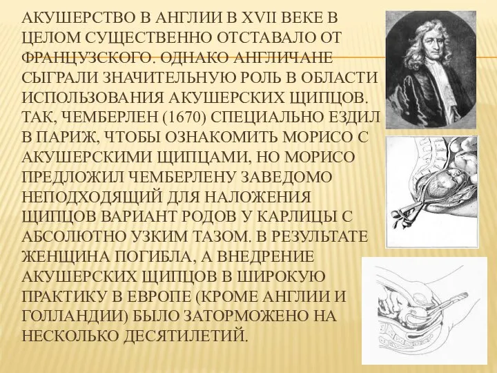 АКУШЕРСТВО В АНГЛИИ В XVII ВЕКЕ В ЦЕЛОМ СУЩЕСТВЕННО ОТСТАВАЛО ОТ