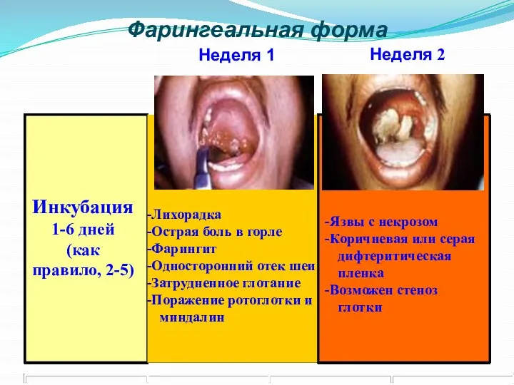 Инкубация 1-6 дней (как правило, 2-5) Неделя 1 Неделя 2 Фарингеальная