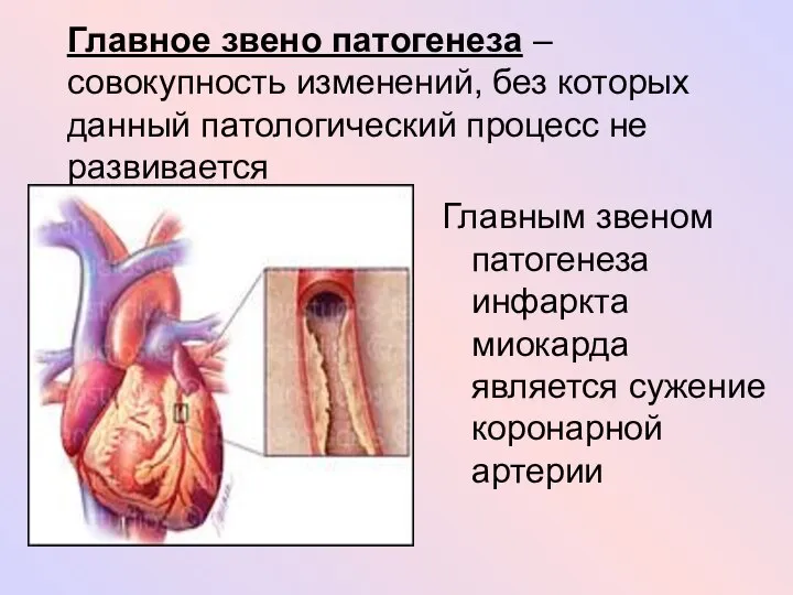 Главное звено патогенеза – совокупность изменений, без которых данный патологический процесс