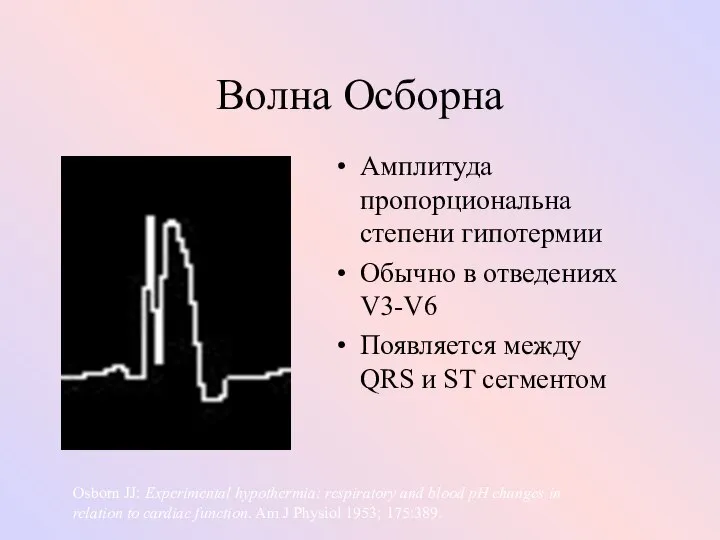 Волна Осборна Амплитуда пропорциональна степени гипотермии Обычно в отведениях V3-V6 Появляется