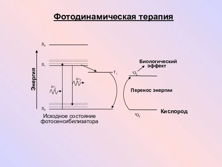 Фотодинамическая терапия