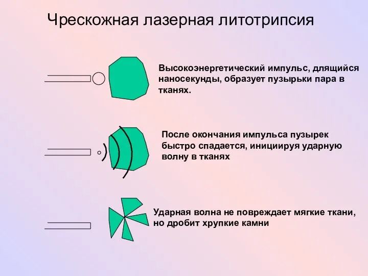 Высокоэнергетический импульс, длящийся наносекунды, образует пузырьки пара в тканях. После окончания