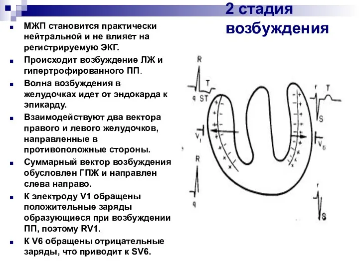 2 стадия возбуждения МЖП становится практически нейтральной и не влияет на