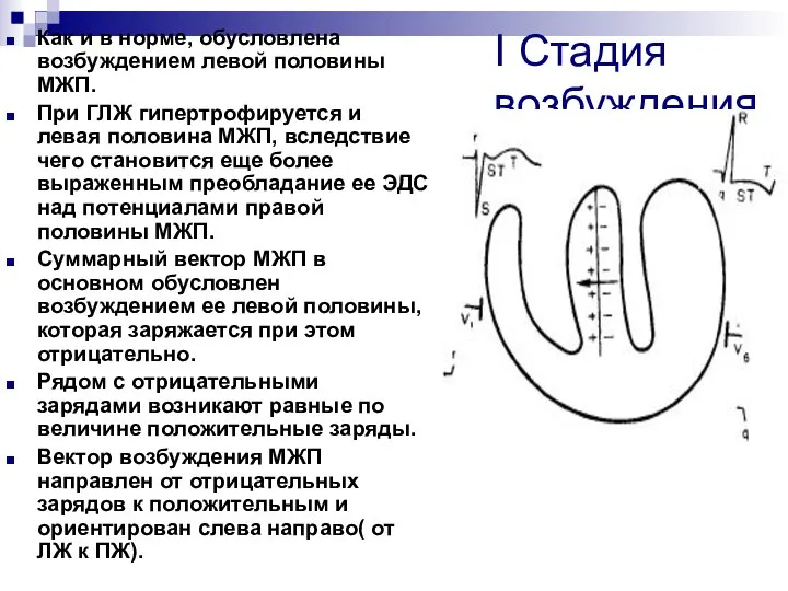 І Стадия возбуждения. Как и в норме, обусловлена возбуждением левой половины