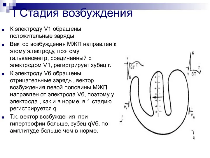 І Стадия возбуждения К электроду V1 обращены положительные заряды. Вектор возбуждения