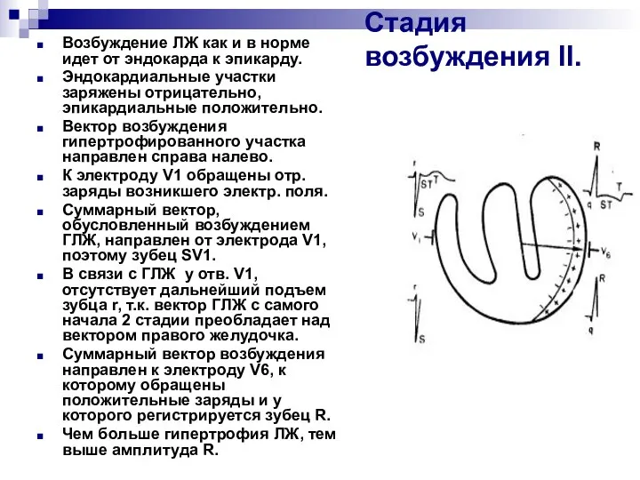 Стадия возбуждения ІІ. Возбуждение ЛЖ как и в норме идет от