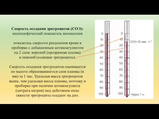 Скорость оседания эритроцитов (СОЭ): неспецифический показатель воспаления показатель скорости разделения крови