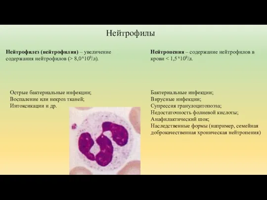 Нейтрофилез (нейтрофилия) – увеличение содержания нейтрофилов (> 8,0 x109/л). Острые бактериальные