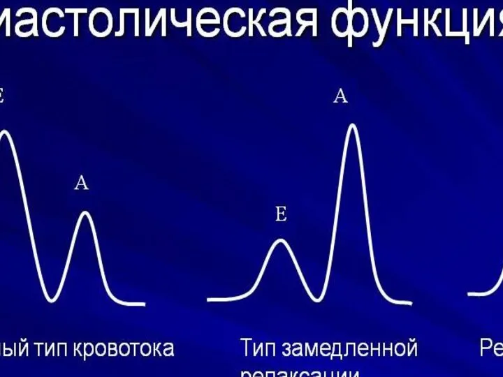 Типы диастолической дисфункции