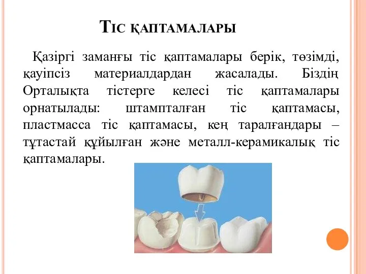 Тіс қаптамалары Қазіргі заманғы тіс қаптамалары берік, төзімді, қауіпсіз материалдардан жасалады.