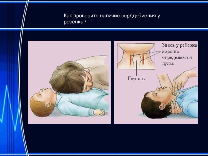 Как проверить наличие сердцебиения у ребенка?