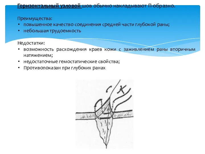 Горизонтальный узловой шов обычно накладывают П-образно. Преимущества: повышенное качество соединения средней