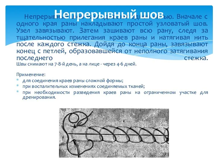 Непрерывный шов накладывают одной нитью. Вначале с одного края раны накладывают