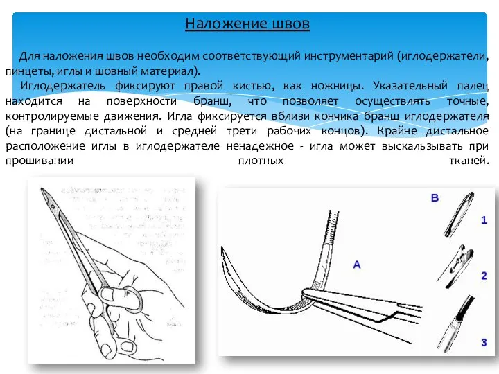 Наложение швов Для наложения швов необходим соответствующий инструментарий (иглодержатели, пинцеты, иглы