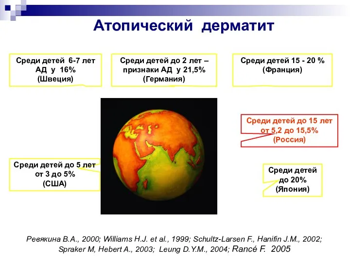 Атопический дерматит Ревякина В.А., 2000; Williams H.J. et al., 1999; Schultz-Larsen