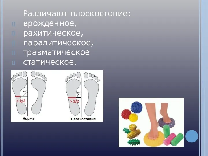 Различают плоскостопие: врожденное, рахитическое, паралитическое, травматическое статическое.