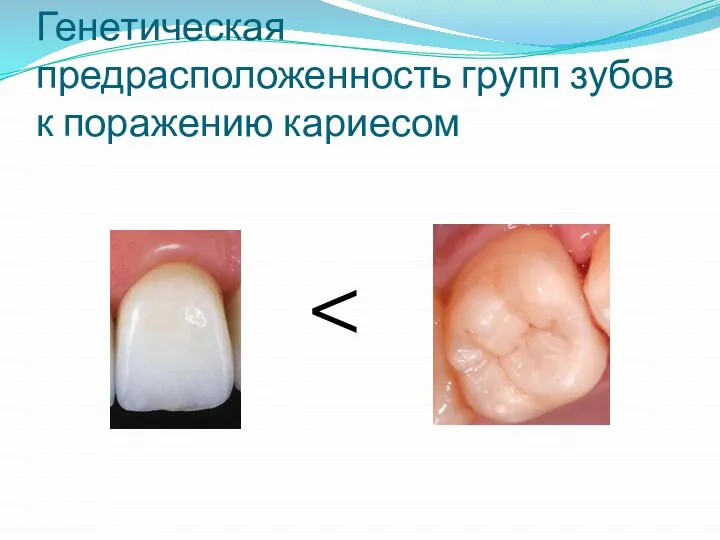 Генетическая предрасположенность групп зубов к поражению кариесом
