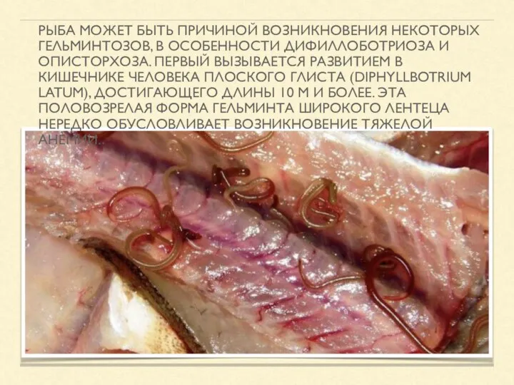 РЫБА МОЖЕТ БЫТЬ ПРИЧИНОЙ ВОЗНИКНОВЕНИЯ НЕКОТОРЫХ ГЕЛЬМИНТОЗОВ, В ОСОБЕННОСТИ ДИФИЛЛОБОТРИОЗА И
