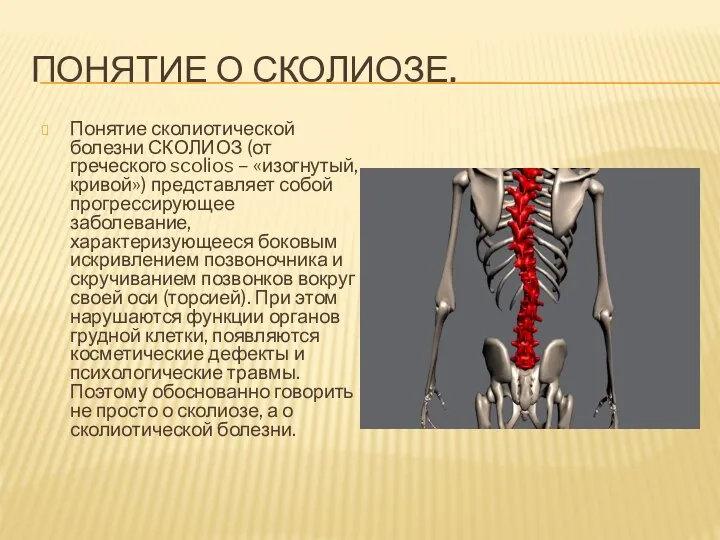 ПОНЯТИЕ О СКОЛИОЗЕ. Понятие сколиотической болезни СКОЛИОЗ (от греческого scolios –