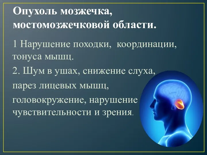 Опухоль мозжечка, мостомозжечковой области. 1 Нарушение походки, координации, тонуса мышц. 2.