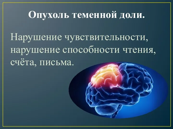 Опухоль теменной доли. Нарушение чувствительности, нарушение способности чтения, счёта, письма.