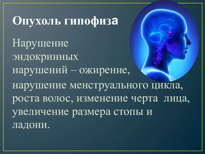 Опухоль гипофиза Нарушение эндокринных нарушений – ожирение, нарушение менструального цикла, роста